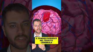 🧠ANEURISMA CEREBRALE🧠 parte del video in background di ZackD Films [upl. by Sherry]