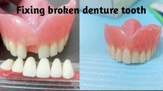 How to fix broken denture tooth [upl. by Fabian]