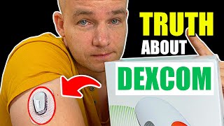 Dexcom G6  My Honest Review after 7 Months [upl. by Uah]