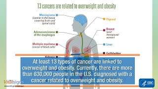 Overweight and Obesity are Associated with Cancer [upl. by Annayt]