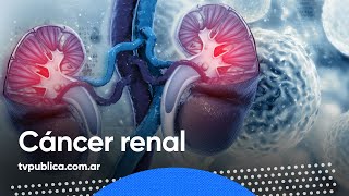 Cáncer renal prevención síntomas y tratamiento – En Casa Salud [upl. by Hgielar]