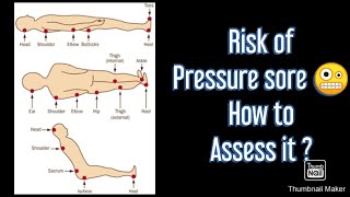 Braden Risk Assessment Scale Bed sore Pressure sore Risk of Bed sore bed ridden [upl. by Pleasant]