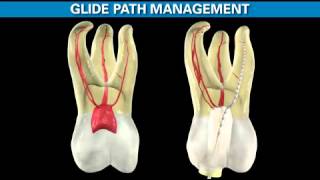 ProTaper Gold  Shaping the Future of Endodontics  Dentsply Sirona [upl. by Kiele]