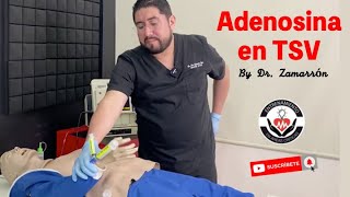 TAQUICARDIA SUPRAVENTRICULAR  ¿Cómo administrar la ADENOSINA [upl. by Imiaj]