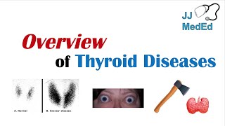 Overview of Thyroid Diseases Hashimoto’s Graves’ Sick Euthyroid Syndrome Toxic adenoma etc [upl. by Lindon]