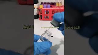 BLOOD TYPING BLOOD GROUPING PROCEDURE [upl. by Richia]