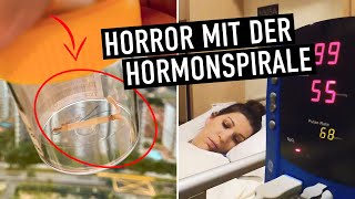 HORMONSPIRALE  Entfernung durch OP um € 1300  😱 Was dir davor niemand erzählt [upl. by Rolyak]