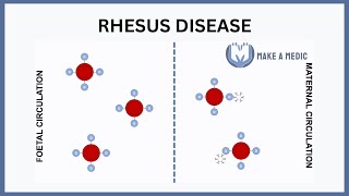 Rhesus Disease Explained [upl. by Worthy]