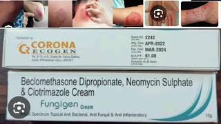 Fungigen Cream Beclomethasone Dipropionate Neomycin Sulphate amp Clotrimazole Cream [upl. by Folger648]