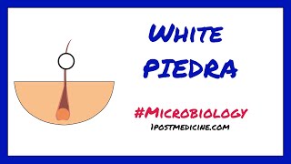 White Piedra  Microbiology [upl. by Ytsud]