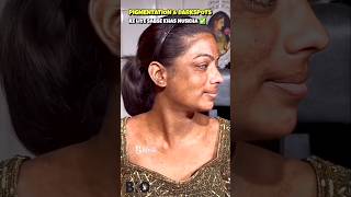 ✅How To Remove DARK SPOTS amp PIGMENTATION From Face Naturally shorts beautykadose [upl. by Arratal]