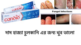 Candid cream uses in Bengali  candid cream full review in Bengali  ringworm itching er jonno valo [upl. by Galasyn102]