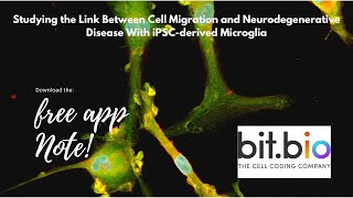 Studying the Link Between Cell Migration and Neurodegenerative Disease With iPSC derived Microglia [upl. by Enad171]