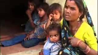 Malnutrition Its Causes in Children of Indias Poor  Nutritionist Raksha Changappa Video Playlist [upl. by Orv922]