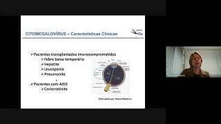 Aula Citomegalovirus  Setembro 2021 [upl. by Mcintosh]