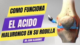 QUÉ HACE EL ÁCIDO HIALURÓNICO EN SU RODILLA doctorjuancarlosalbornoz artrosisderodilla [upl. by Nnaihs333]