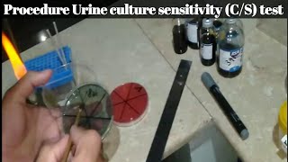 Urine culture sensitivity CS test Procedure [upl. by Huesman997]