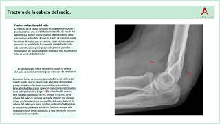 64 Conceptos prácticos del codo y antebrazo Clase de Anatomía Humana de Gray [upl. by Rosemary592]