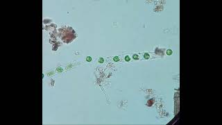 Microspora cells becoming flagellated Zoospores  real time [upl. by Zielsdorf]