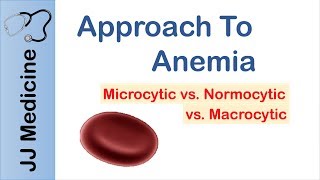 Anemia  Microcytic vs Normocytic vs Macrocytic [upl. by Mcfadden]