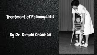 Polio Treatment  Poliomyelitis Treatment [upl. by Steffen]