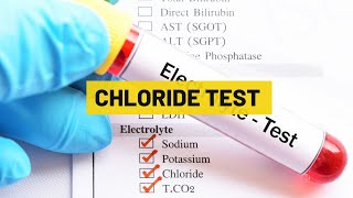 Chloride Test  My Lab Solution [upl. by Samuel]