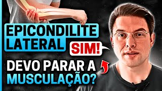 Quem tem EPICONDILITE LATERAL pode fazer MUSCULAÇÃO  Muzy Explica [upl. by Kolnos781]