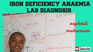 Iron Deficiency Anaemia  Causes amp Signs  Lab diagnosis  Hematology [upl. by Laux]