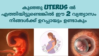 Early Pregnancy Symptoms Deechus world Malayalam [upl. by Elias]