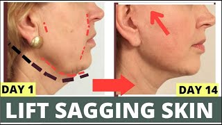 HOW TO LIFT SAGGING SKIN  FACE LIFTING EXERCISES FOR SAGGY JOWLS SAGGY CHEEKS  CHEEKS LIFT [upl. by Paza]