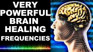 EXTREME BRAIN HEALING FREQUENCIES FOR STUDY FOCUS MIND POWER CONFIDENCE MEDITATION  MUST TRY [upl. by Boone668]