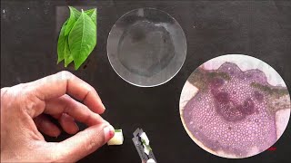 Adhatoda Vasaka Leaf  How to Do Section Cutting amp Microscopy of Vasaka Leaf  सेक्शन कटिंग ऑफ़ लीफ [upl. by Martinez]