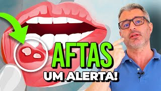 O que significa ter AFTAS e como evitálas 🔴 [upl. by Anibla473]