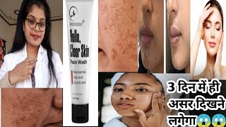 Woodoo Hello Clear Skin Face Wash Honest ReviewHello clear skin face wash usesampside effects review [upl. by Malloch]