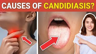 10 Shocking 😳 Causes of Candidiasis that you Might dont Know  Credihealth [upl. by Netnilc993]