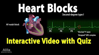 Heart AV Blocks  INTERACTIVE Animation with Quiz [upl. by Dadinirt558]