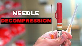 How To Chest Needle Decompression [upl. by Htebazil]