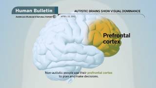 Science Bulletins Autistic Brains Show Visual Dominance [upl. by Dougal796]