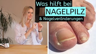 Was hilft bei Nagelpilz und Nagelveränderungen  Hintergründe  Tipps  Erklärungen [upl. by Jamilla]