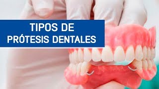 Tipos de prótesis dentales  Odontoespecialistas [upl. by Yniffit]