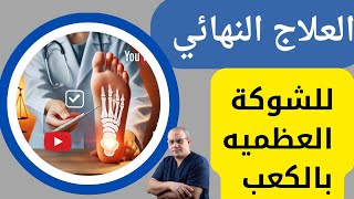 علاج الشوكة العظمية بالموجات التصادميةعلاج الشوكة العظميةفي كعب القدم مسمار القدم [upl. by Aihsad]