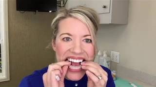 Teeth Whitening Instructions [upl. by Loretta162]