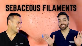 Black Dots on the Nose Heres How To Treat Sebaceous Filaments [upl. by Annirtak]