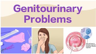 Genitourinary Problems  Vulvovaginal Candidiasis [upl. by Power]