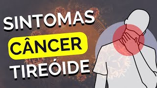 Sintomas do câncer De tireóide [upl. by Aikyt]