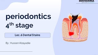 Periodontics Stage4 Lec 6 Dental Stains  DentaVersa Academy  دنتافيرسا اكادمي [upl. by Lammaj]