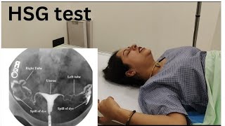 My HSG  tube test  experience😓 without anesthesia bht painfull hota h [upl. by Gaskins]