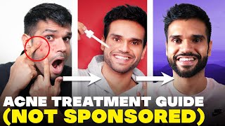 PIMPLE pe thook mat bro Acne Treatment Guide  How To Remove Acne  BeYourBest Skincare San Kalra [upl. by Adlemy]