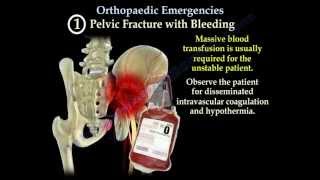 Orthopaedic Emergencies Part 1  Everything You Need To Know  Dr Nabil Ebraheim [upl. by Andrade]