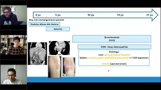 Granulomas in PID and other immune dysregulated conditions  Tuesday Lunch with RITA [upl. by Mushro462]